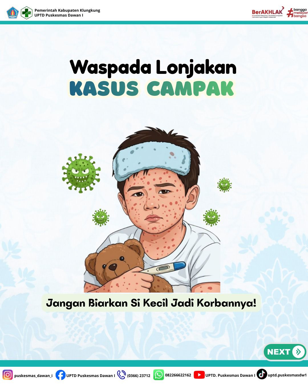 Waspada Campak